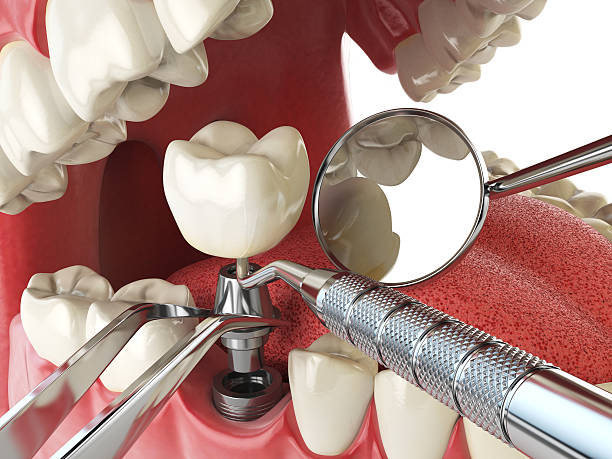 Best Emergency Orthodontic Repairs in Grape Creek, TX